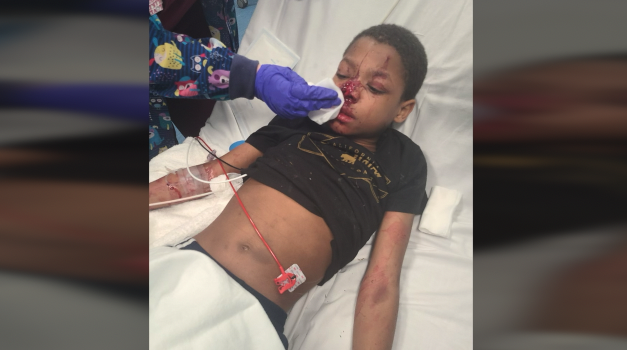 9-Year-Old Injured: Random Dog Bite in Grand Rapids
